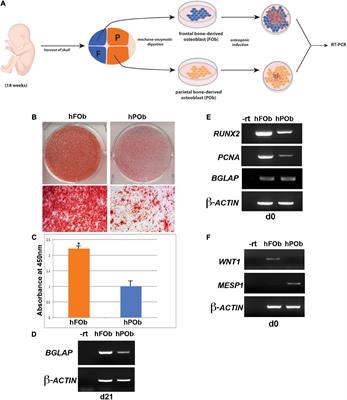 An Evolutionary Conserved Signaling Network Between Mouse and Human Underlies the Differential Osteoskeletal Potential of Frontal and Parietal Calvarial Bones